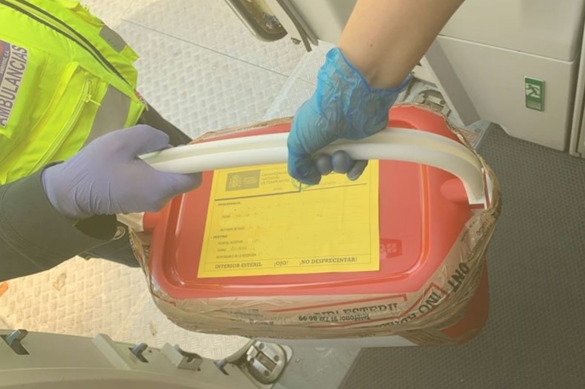 Los riñones son los órganos más transplantados en España.